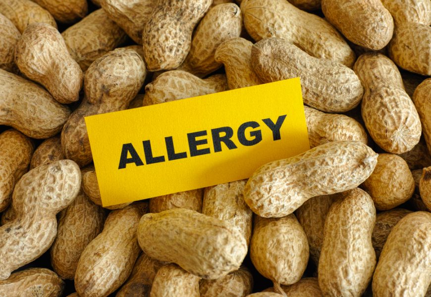 Australian Researchers – Breakthrough in Peanut Allergy Treatment