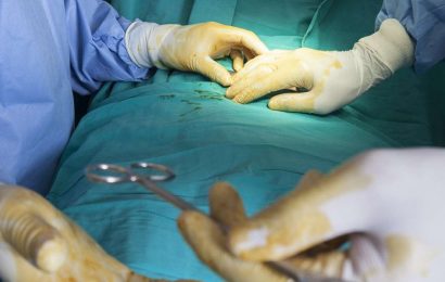 Indian doctors remove giant 7.4kg kidney from man
