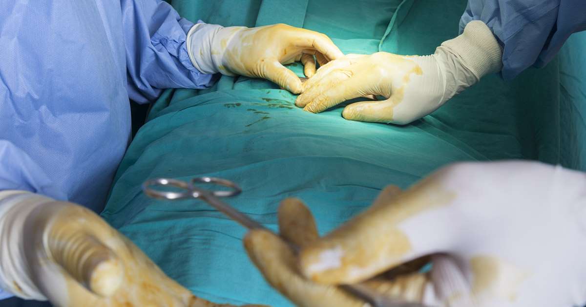 Indian doctors remove giant 7.4kg kidney from man